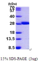 Human GSTM2 Protein (Recombinant His)