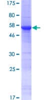 Human DPH6 / ATPBD4 Protein (Recombinant GST)