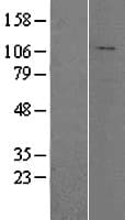 HADHA Protein (Over-Expression Lysate Myc-DDK (Flag))
