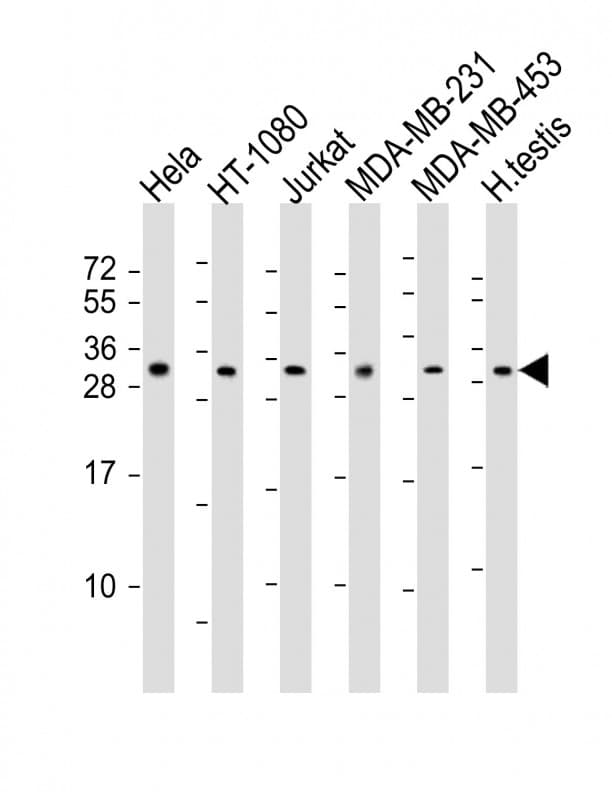 SSX2 Antibody (aa110-142)