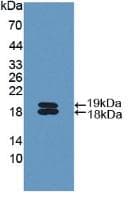IL11RA Antibody (aa194-329)