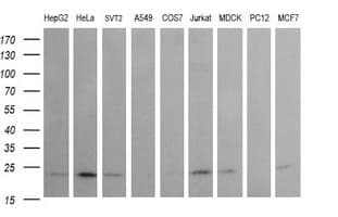Monoclonal Mouse anti-Human RAB24 Antibody (clone OTI3H1, WB)