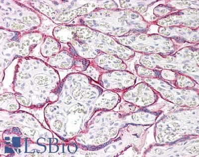 IHC-plus™ Polyclonal Goat anti-Human MAOA / Monoamine Oxidase Antibody (aa141-154, IHC, WB)