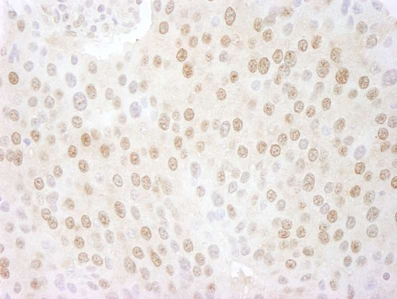 Polyclonal Rabbit anti-Human COPS5 / JAB1 Antibody (aa175-225, IHC)