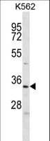 Polyclonal Rabbit anti-Human ELAVL2 / HUB Antibody (aa156-184, IHC, WB)