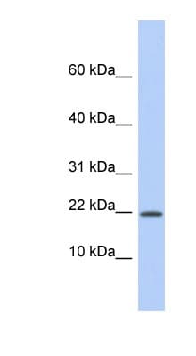 HCFC1R1 / HPIP Antibody (aa35-84)