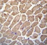 Polyclonal Rabbit anti-Human Hamartin / TSC1 Antibody (aa401-430, IHC, IF, WB)