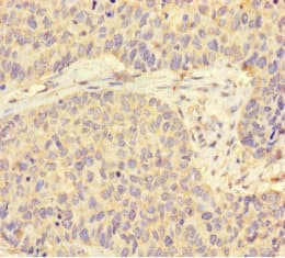 STI1 / STIP1 Antibody