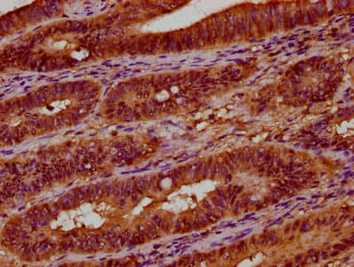 Polyclonal Rabbit anti-Human UGT2B7 Antibody (IHC, IF)