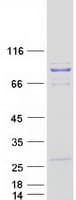 Human PCIF1 Protein (Recombinant Myc-DDK (Flag))