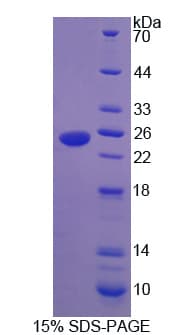 Human HSPB7 / CvHSP Protein (Recombinant His)