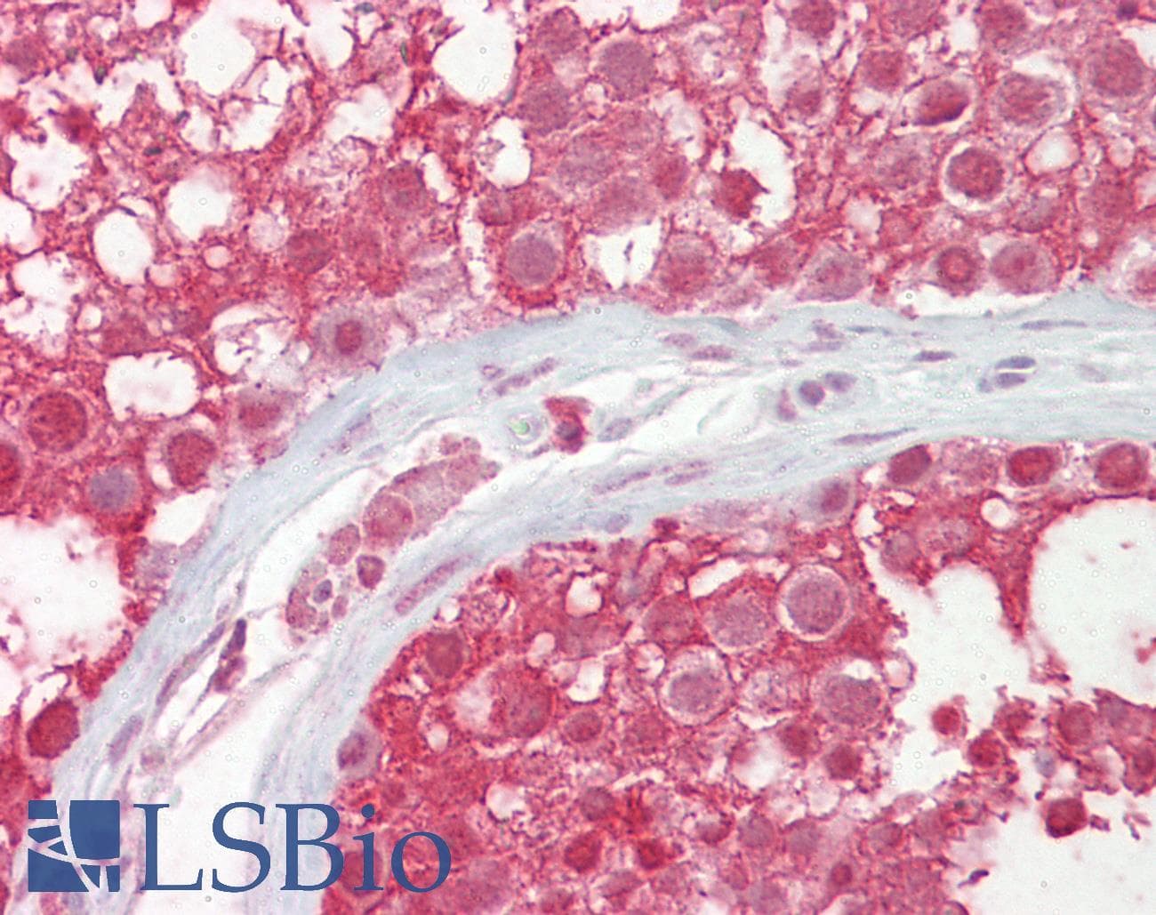 Polyclonal Rabbit anti-Human CUL3 / Cullin 3 Antibody (aa618-667, IHC, WB)