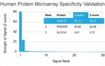AMACR / P504S Antibody (clone AMACR/1864, Ready-to-Use)