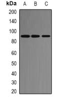 ACE2 / ACE-2 Antibody (Internal)