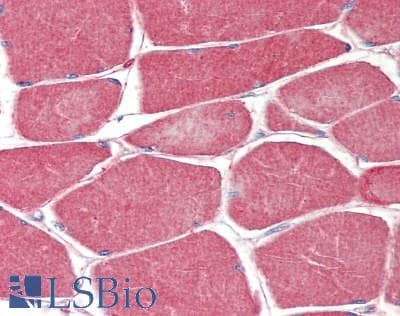 MUSK Antibody (aa517-777)