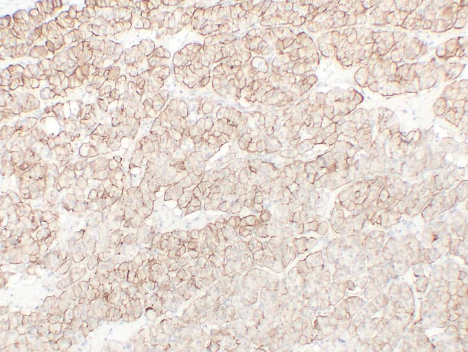 CDH16 / Cadherin 16 Antibody (clone ABT-CDH16)