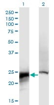 CRYBB2 Antibody (clone 1F1)