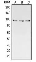 Polyclonal Rabbit anti-Human COL3A1 / Collagen III Antibody (C-Terminus, WB)