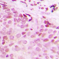 Polyclonal Rabbit anti-Human ESPL1 / Separase Antibody (phospho-Ser801, IHC, IF, WB)