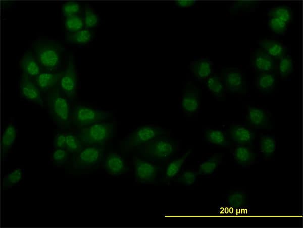 Monoclonal Mouse anti-Human STK38 Antibody (clone 2F6, IHC, IF, WB)