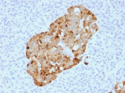 Recombinant Monoclonal Rabbit anti-Human CHGA / Chromogranin A Antibody (clone CHGA/1731R, IHC)