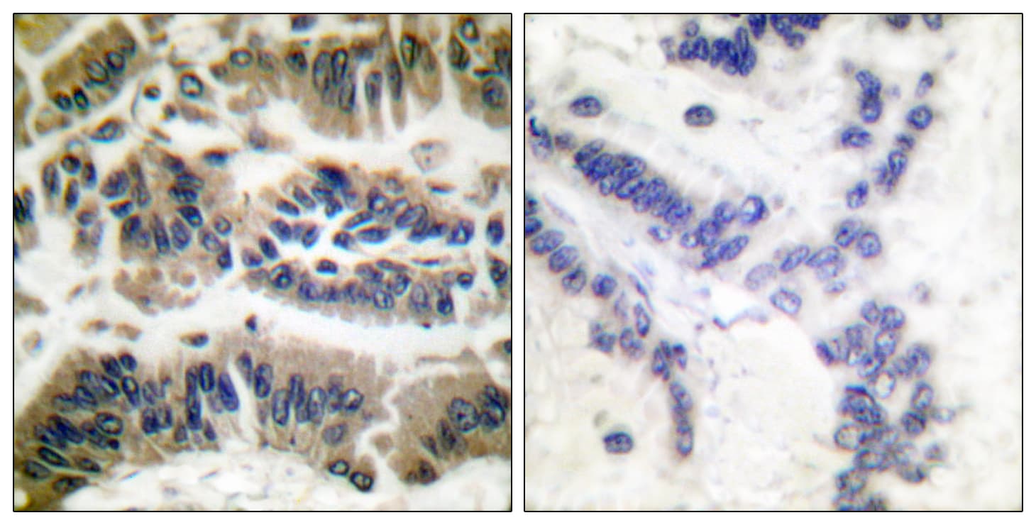 CASP6 / Caspase 6 Antibody (aa223-272)