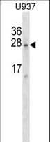 SRA1 / SRA Antibody (aa193-222)
