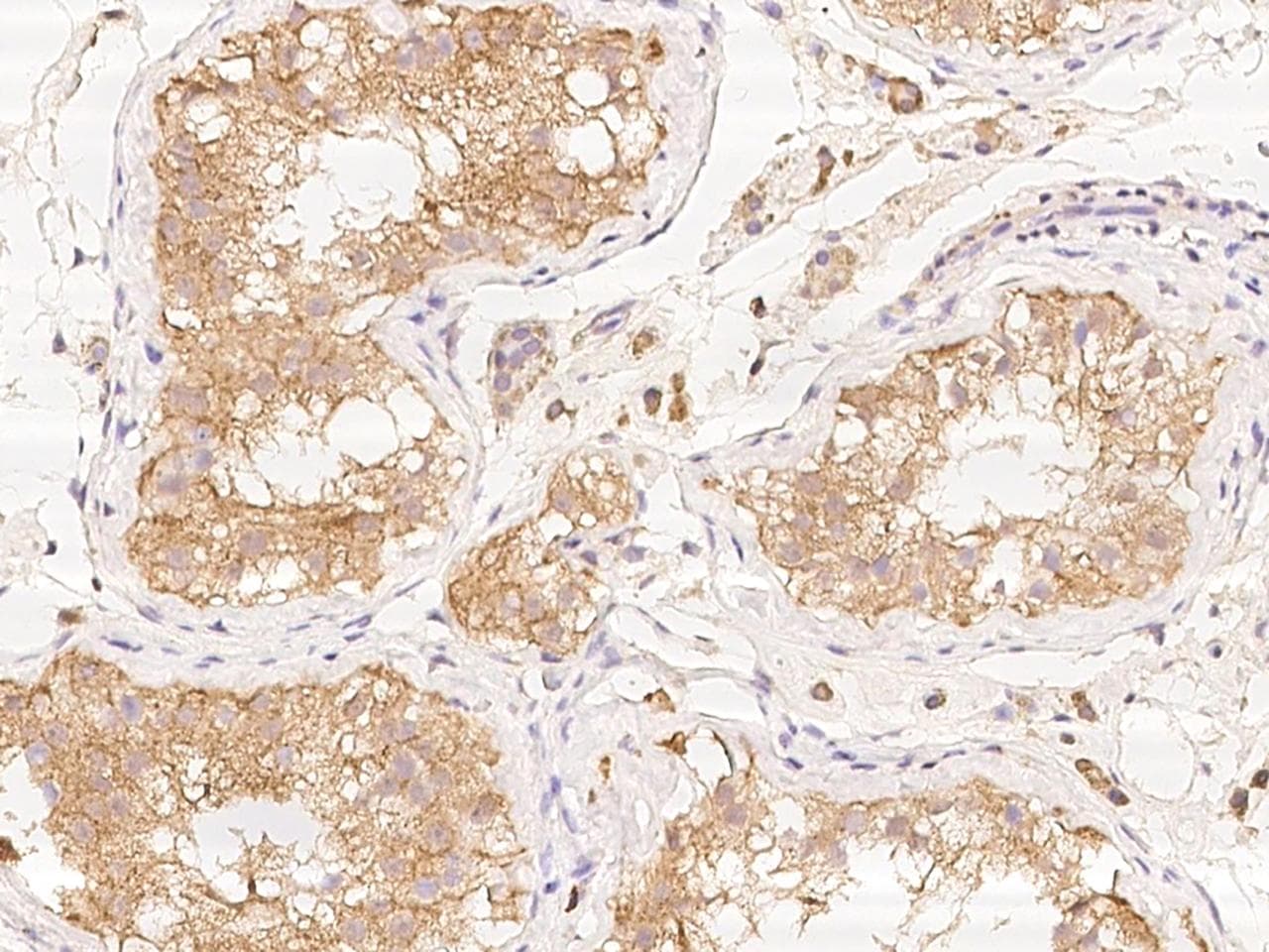 PDPR Antibody