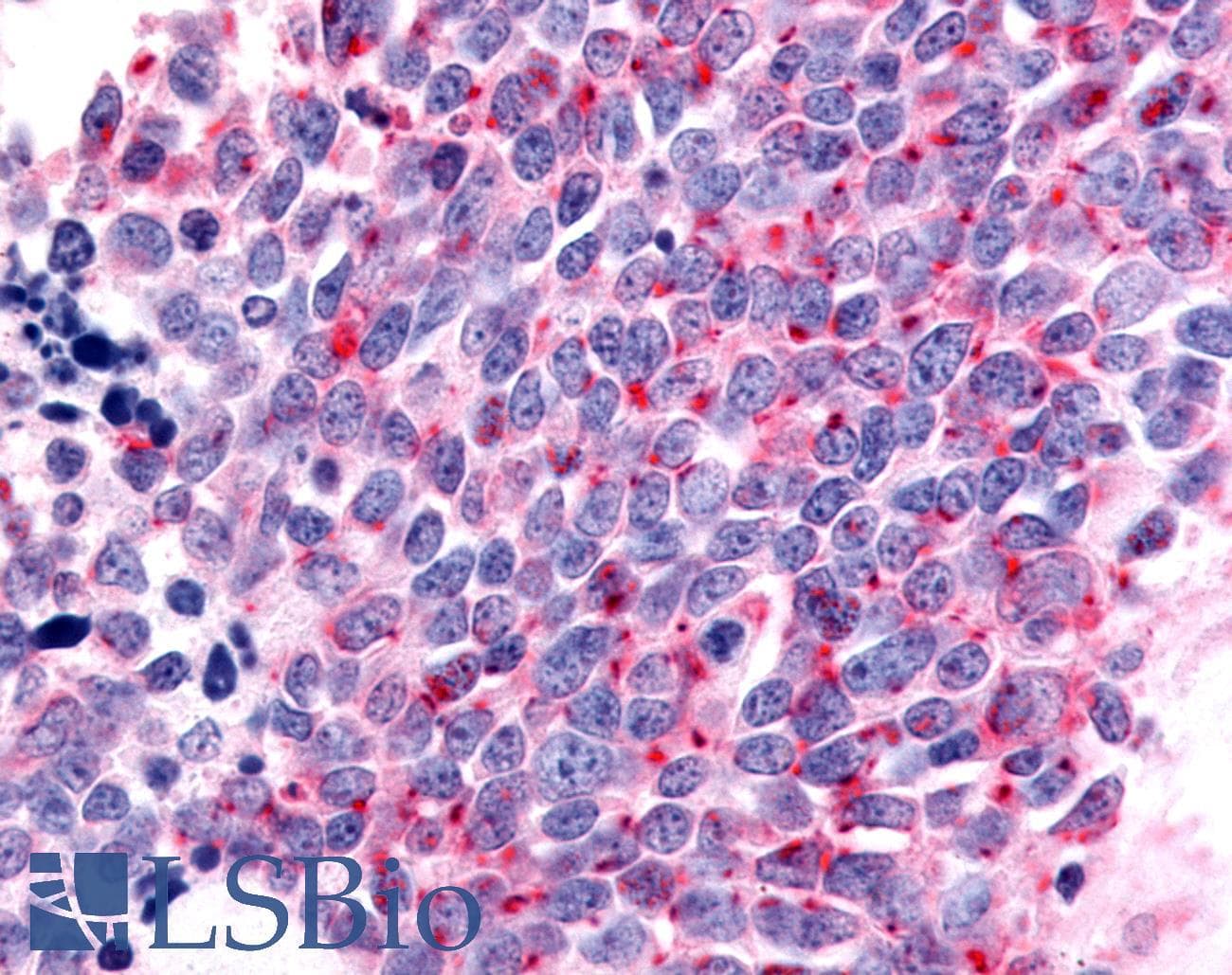PathPlus™ Polyclonal Rabbit anti-Human OR6K3 Antibody (C-Terminus, IHC)