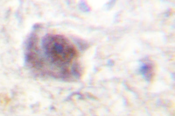 Polyclonal Rabbit anti-Human APC Antibody (Lys2050, IHC)