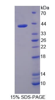 Human IRF5 Protein (Recombinant 6His, N-terminus)
