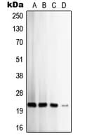 TIMP2 Antibody (Internal)