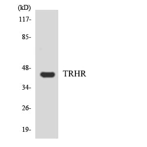 TRH Receptor / TRHR Antibody (aa185-234)