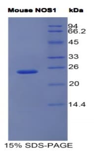 Mouse NOS1 / nNOS Protein (Recombinant His, N-terminus)