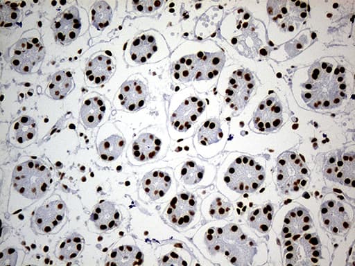 Monoclonal Mouse anti-Human SMC1A / SMC1 Antibody (clone OTI2D12, aa889-1016, IHC, WB)