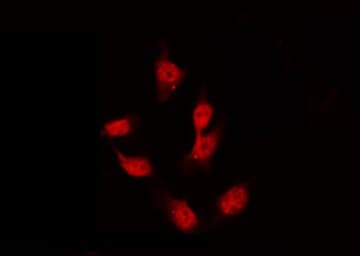 GATA4 Antibody (phospho-Ser105)