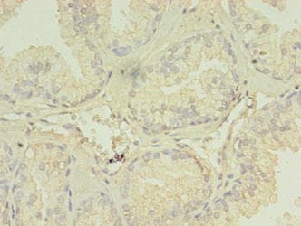 SPRING / TRIM9 Antibody (aa1-550)