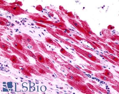 PathPlus™ EDNRA / Endothelin A Receptor Antibody (Extracellular Domain)