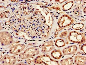Polyclonal Rabbit anti-Human CPSF6 Antibody (IHC, IF, WB)