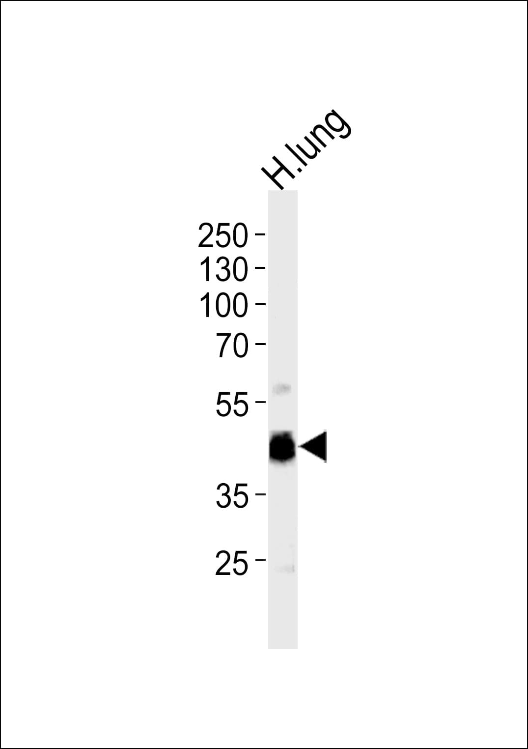 MOK / RAGE Antibody (aa206-234)