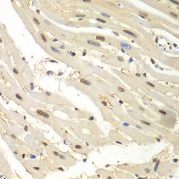 Polyclonal Rabbit anti-Human HDAC2 Antibody (IHC, IF, WB)