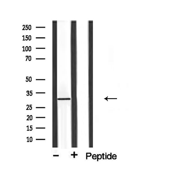 Polyclonal Rabbit anti-Human GC1qR / C1QBP Antibody (IHC, IF, WB)