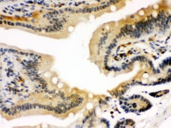 Polyclonal Rabbit anti-Human STAT1 Antibody (IHC, WB)