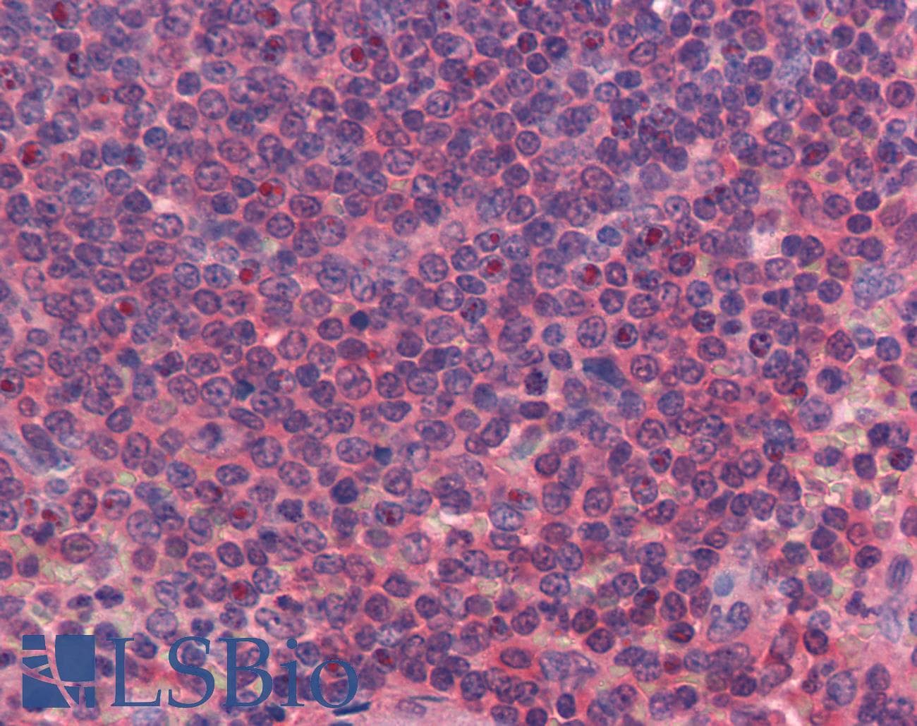 IHC-plus™ URP2 / FERMT3 Antibody