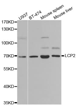 Polyclonal Rabbit anti-Human LCP2 / SLP-76 Antibody (IHC, IF, WB)