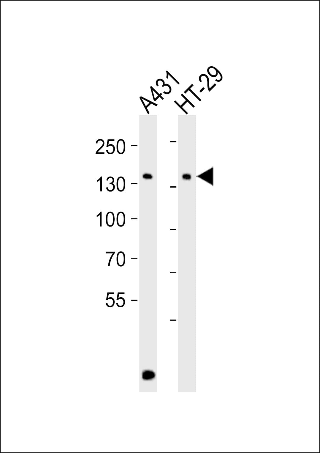 CTR9 Antibody (aa1022-1056)