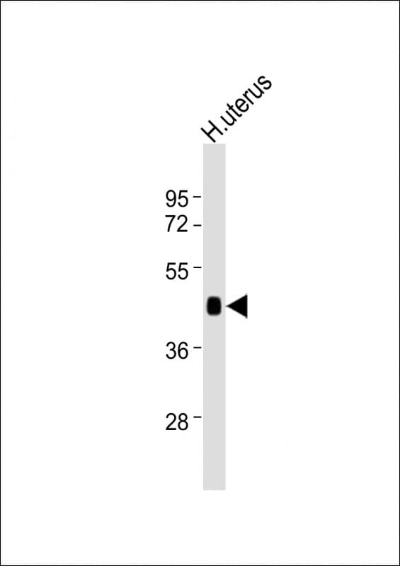 Polyclonal Rabbit anti-Human WNT7A Antibody (WB)