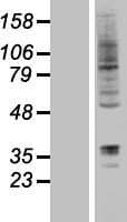 RNF19A / DORFIN Protein (Over-Expression Lysate Myc-DDK (Flag))