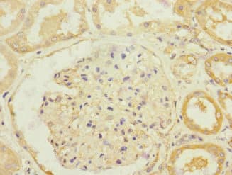 Polyclonal Rabbit anti-Human SLC13A2 / NaCT Antibody (IHC, WB)