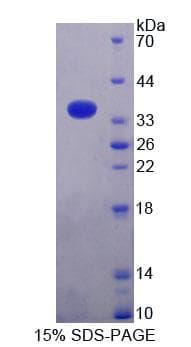 Mouse MRPL2 Protein (Recombinant His-T7, N-terminus)